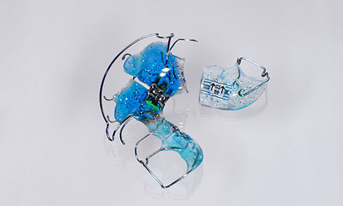 SOS-Hilfe bei Problemen mit Zahnspangen